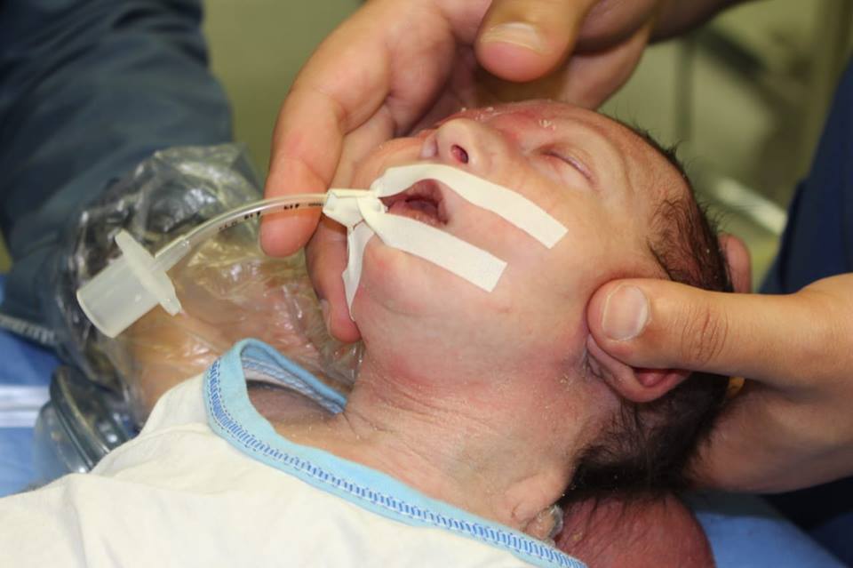 صحة النجف الاشرف  عملية فتح جمجمة لطفل ذو 30 يوما
