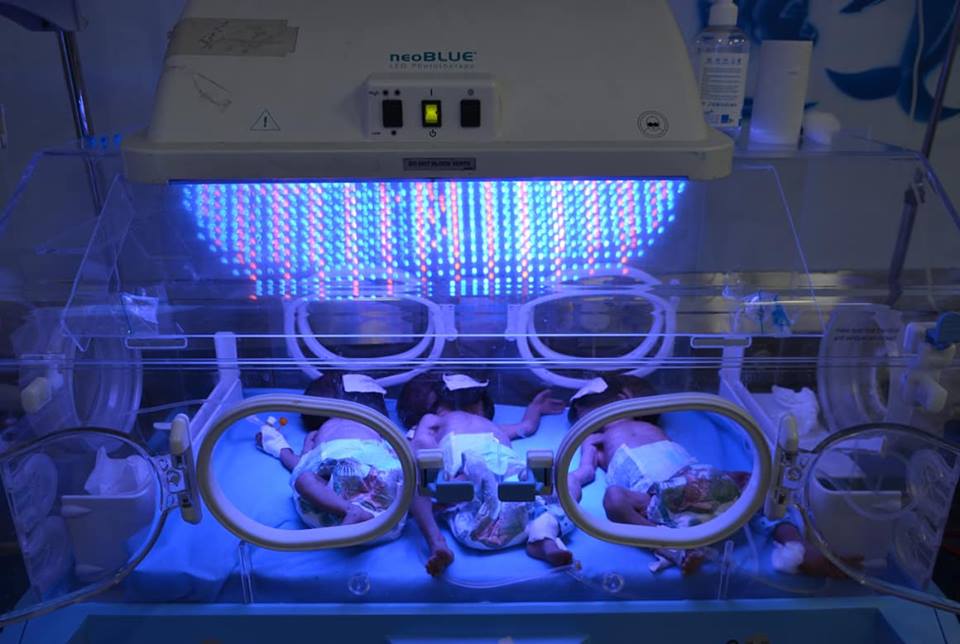 صحة النجف الاشرف   ولادة توأم رباعي في مستشفى الزهراء للولادة